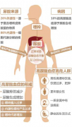 尿酸偏高的原因是什么？该如何科学有效降尿酸