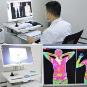 膝关节变形的原因