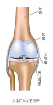 风湿关节图1.jpg