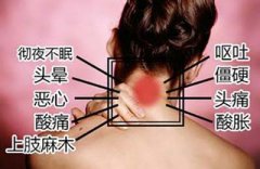 颈椎病引起的危害需谨慎
