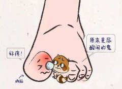 痛风病人可以饮酒吗？
